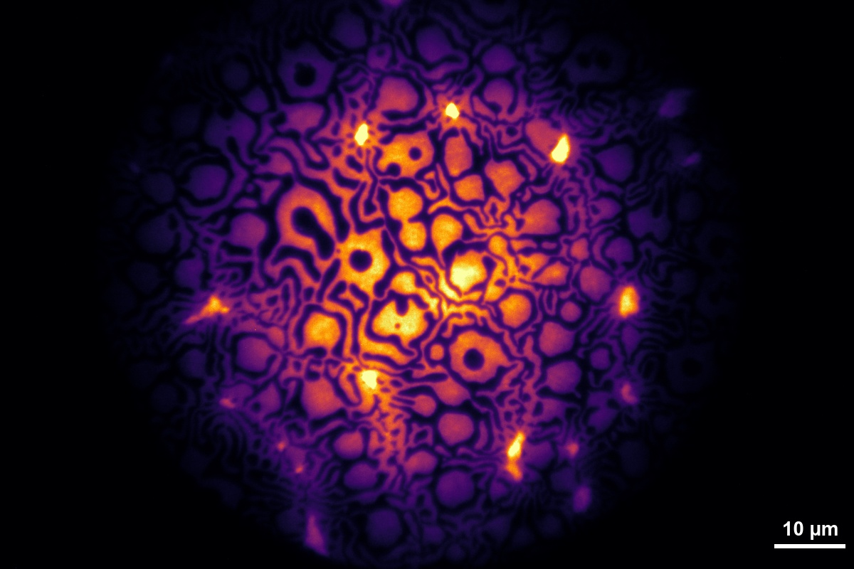 Fluorescence Microscopy Image